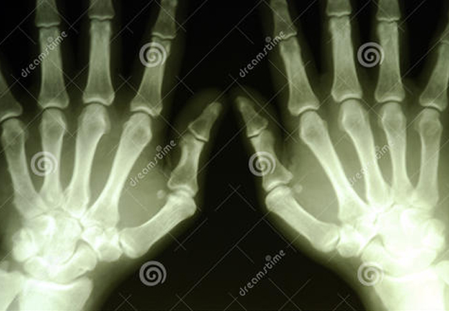 守門神揭秘:安檢機的X射線